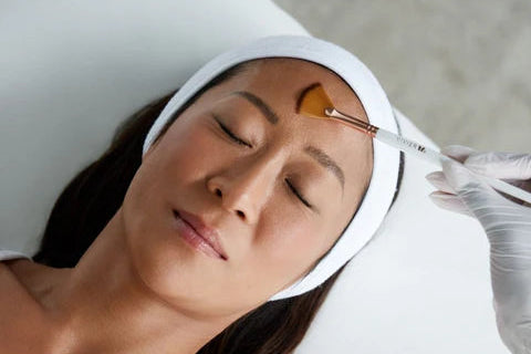 Vivier Peel